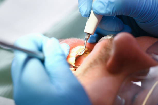 Best Emergency Broken Tooth Repair in Junction, TX