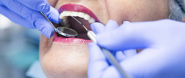 Best Emergency Treatment for Toothache in Junction, TX